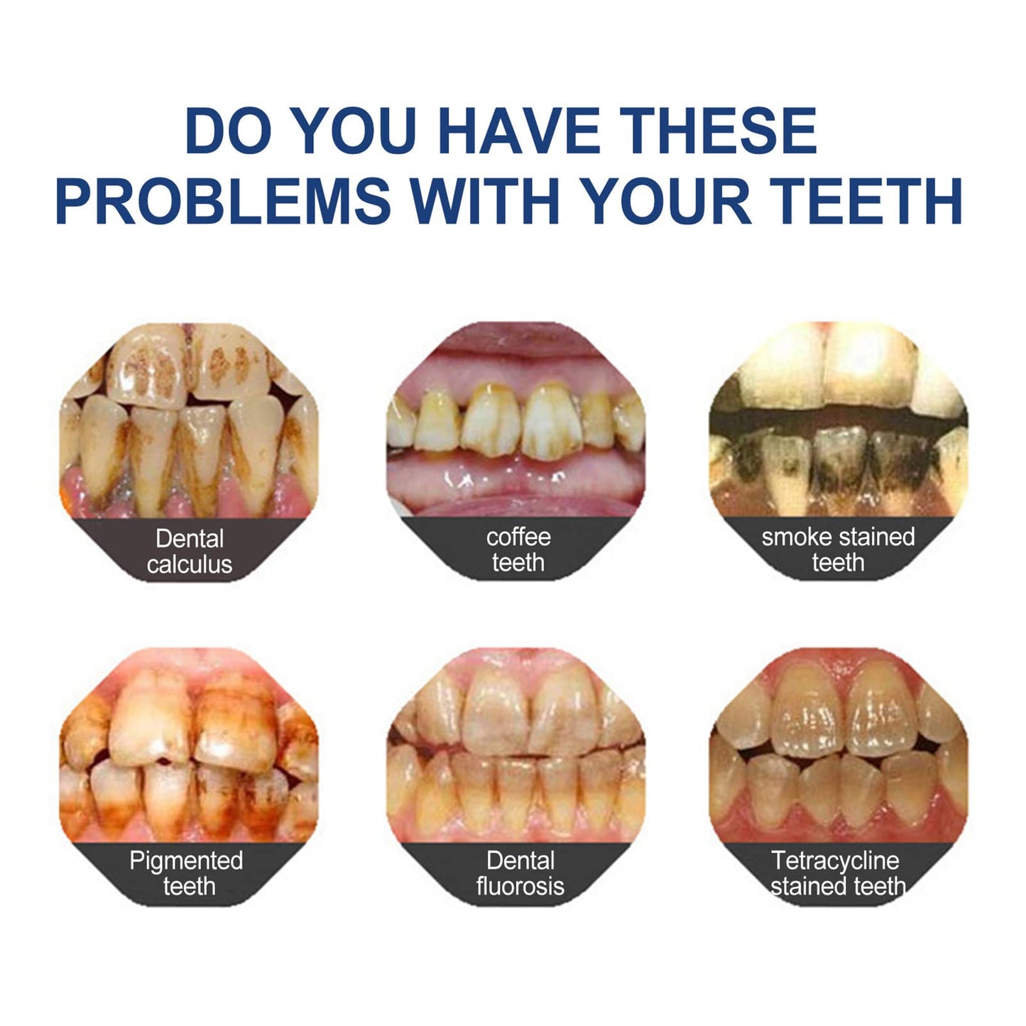 🔥 Final Day 75% OFF 🔥- Official Store💎 Fluoride-Free Hydroxyapatite Toothpaste