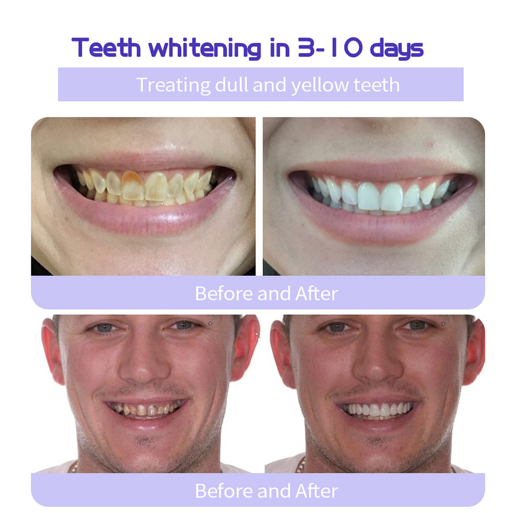 🔥 Final Day 75% OFF 🔥- Official Store💎 Fluoride-Free Hydroxyapatite Toothpaste
