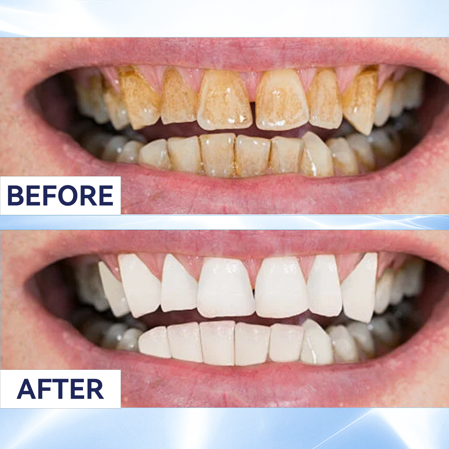 Last 3 Hours:50% Off Remineralizing Gum