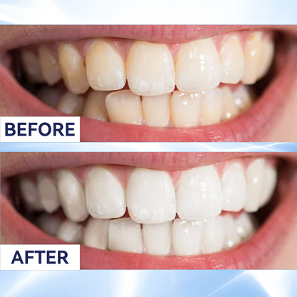 Last 3 Hours:50% Off Remineralizing Gum