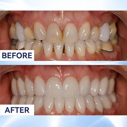 Last 3 Hours:50% Off Remineralizing Gum