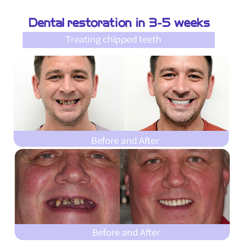 🔥 Final Day 75% OFF 🔥- Official Store💎 Fluoride-Free Hydroxyapatite Toothpaste