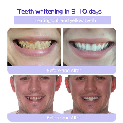 🔥 Final Day 75% OFF 🔥- Official Store💎 Fluoride-Free Hydroxyapatite Toothpaste